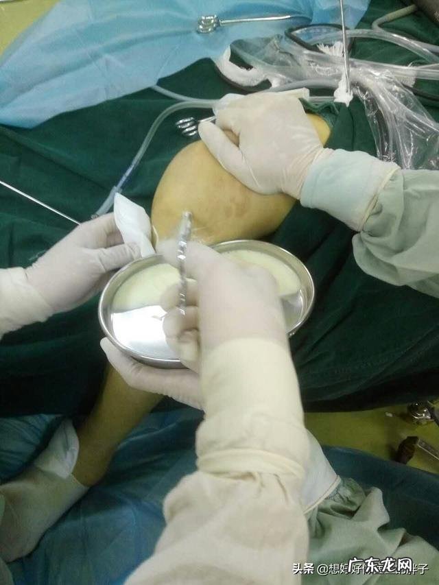 体寒的人冷暖交替膝盖疼该怎么办