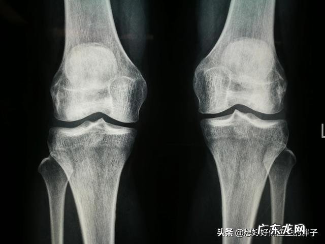 体寒的人冷暖交替膝盖疼该怎么办