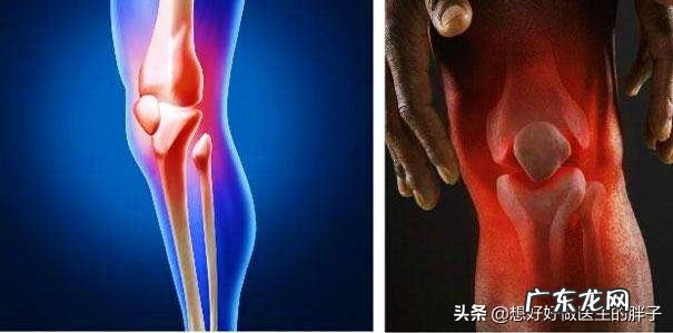 体寒的人冷暖交替膝盖疼该怎么办