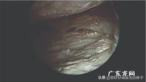 体寒的人冷暖交替膝盖疼该怎么办