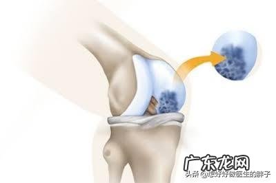 体寒的人冷暖交替膝盖疼该怎么办