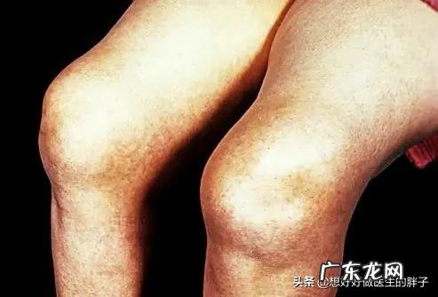 体寒的人冷暖交替膝盖疼该怎么办