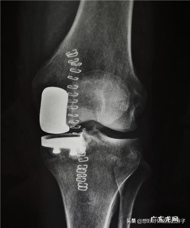 体寒的人冷暖交替膝盖疼该怎么办
