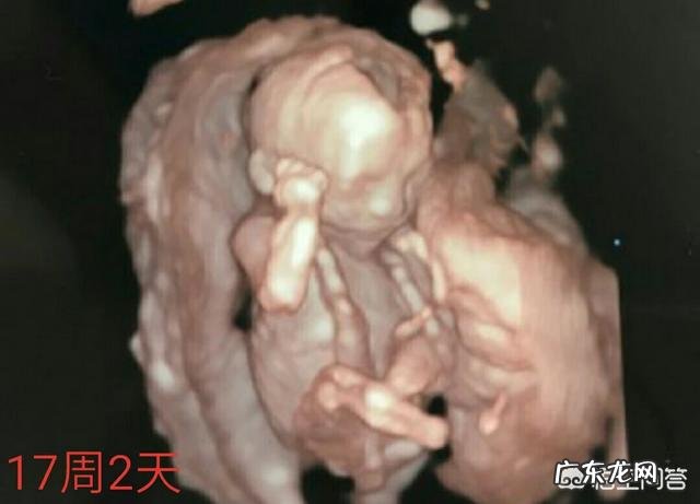 怀孕17周的时候,胎儿已经成型了吗?是怎样的?