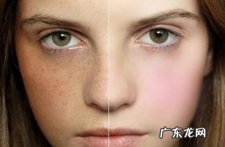 美白丸哪一种最有效 美白丸快速美白推荐