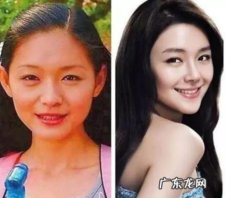 全身美白项目 美白针项目名称