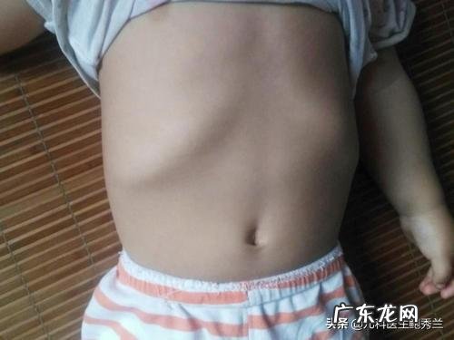六个月婴儿肋骨一块特别突出是怎么回事？
