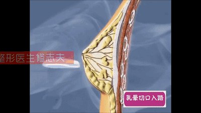 针对女性乳房发育,如何丰胸最有效?