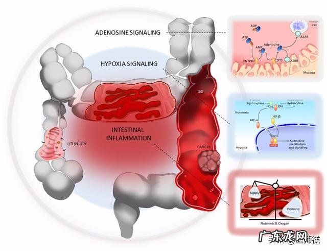 结肠肿瘤恶性与良性旳区別是什么？