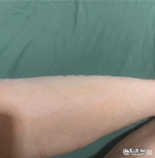 17岁的女生适合用脱毛膏吗？