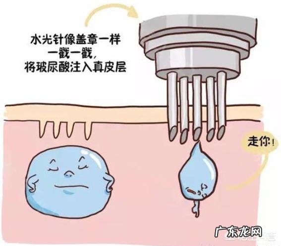 为了保持效果，水光针需要多久打一次？