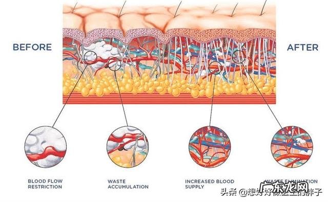 神奇的体外冲击波疗法,是怎样的操作
