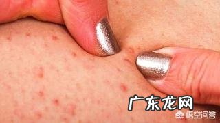 痘痘源源不断的长,和护肤品有关系吗