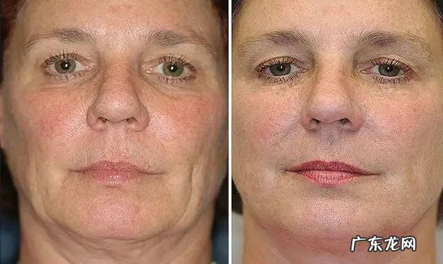 褪黑素保健品真能zhi失眠吗？