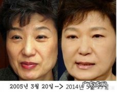 在韩国整容是不是很普遍的事情？