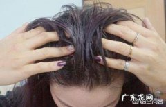 头发容易出油，头皮容易长痘怎么zhi疗才能很好的缓解