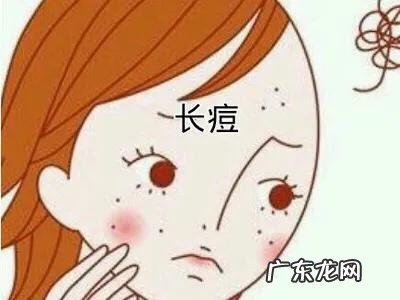 头发容易出油,头皮容易长痘怎么zhi疗才能很好的缓解