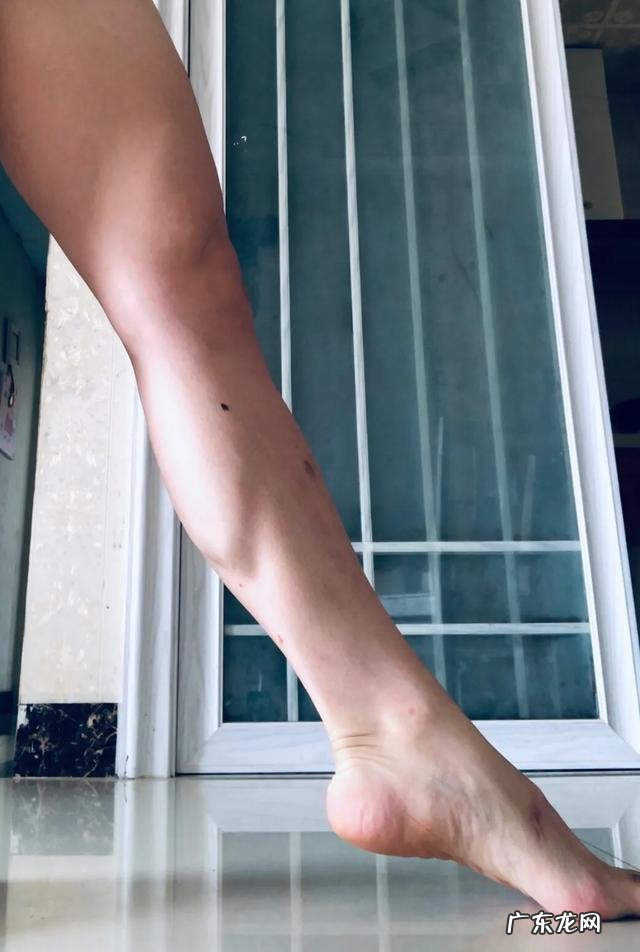 有没有什么方法可以减掉小腿肌肉和胳膊肥肉?