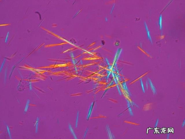 如何预防高尿酸血症的发生