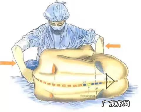 麻醉就是睡一觉这么简单吗?