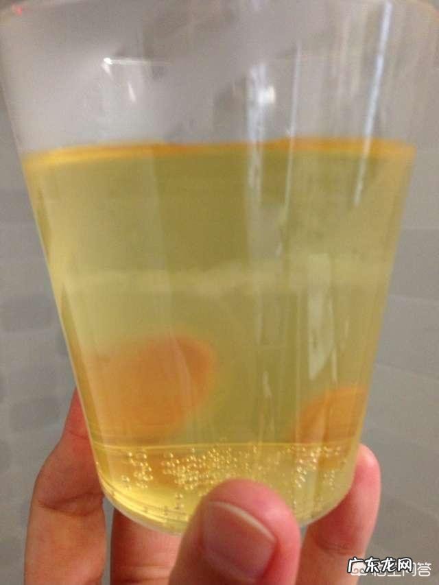 关于皮肤护理的问题,孕妇可以做哪些呢?