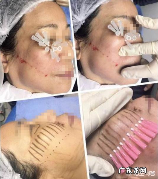 纳米胶原蛋白为什么要放在蛋白线之前吃?