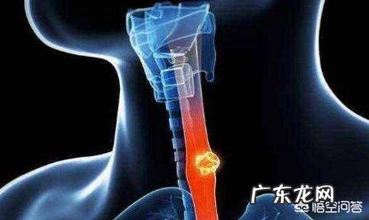 食道癌有哪些症状?会疼吗?