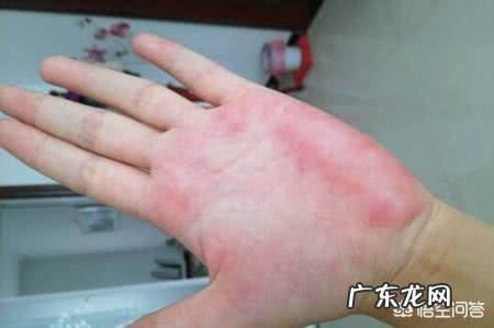 对比新冠肺炎和癌症、重症,大家怎么看? 怎么分辨新冠肺炎重症