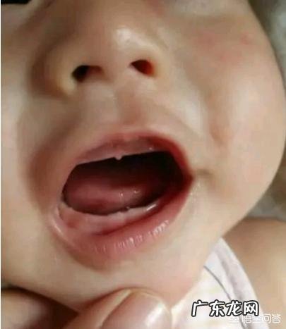 婴儿出牙晚好还是不好?正常情况什么时候出牙?