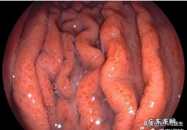 胃不好,经常打嗝、反酸、胃胀,是小毛病吗,该注意什么?