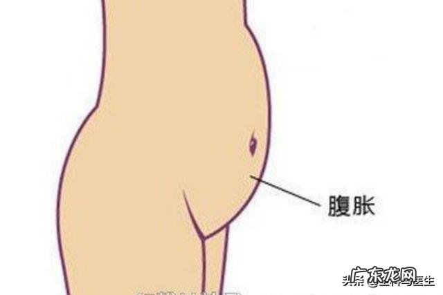 胃不好,经常打嗝、反酸、胃胀,是小毛病吗,该注意什么?