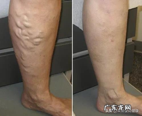 袜子鞋可以搭配什么裤子穿好看?穿出时尚感?