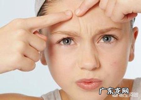 脸上有痘痘真的是内分泌失调吗