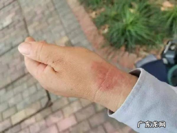 孕妇街头突然独自分娩 23岁孕妇在街头急产