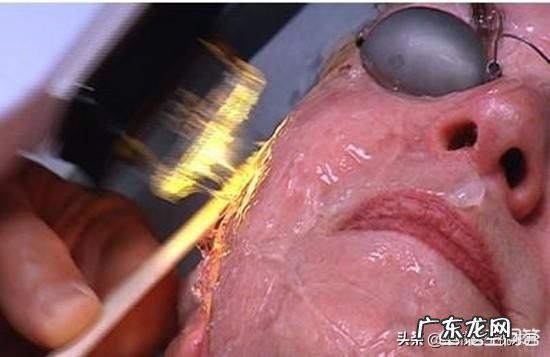 快40岁了,好担心皮肤会衰老长皱纹斑点,有什么可以延缓衰老