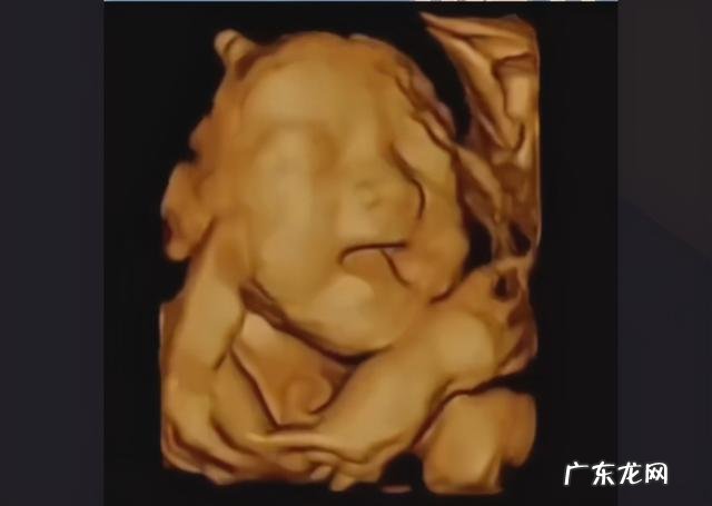 孕妇只要注意三点就不会有黄疸 孕期注意什么小孩出生不会有黄疸