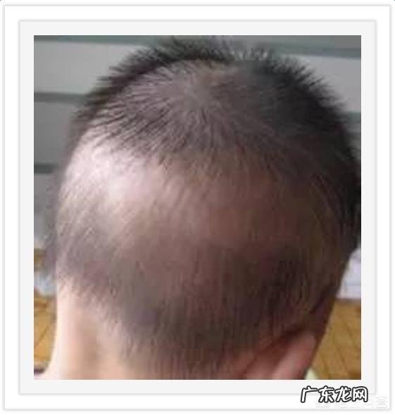 刚满月的宝宝,要不要给他做触觉刺激啊