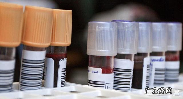 怀孕最后一次B超应该在什么时候做?