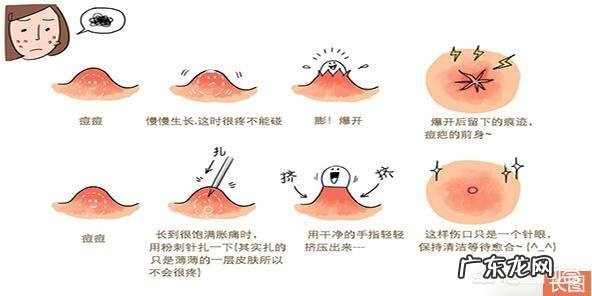 容易长痘痘说明\＂中毒\＂太深了，吃什么排毒效果好？