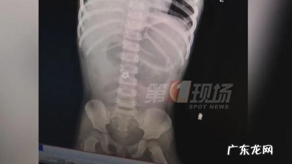 女生误食水宝宝怎么办