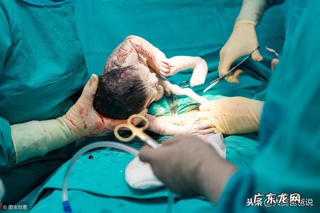 刚出生的宝宝啥样的才好看