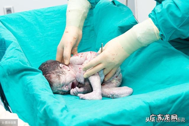 刚出生的宝宝啥样的才好看