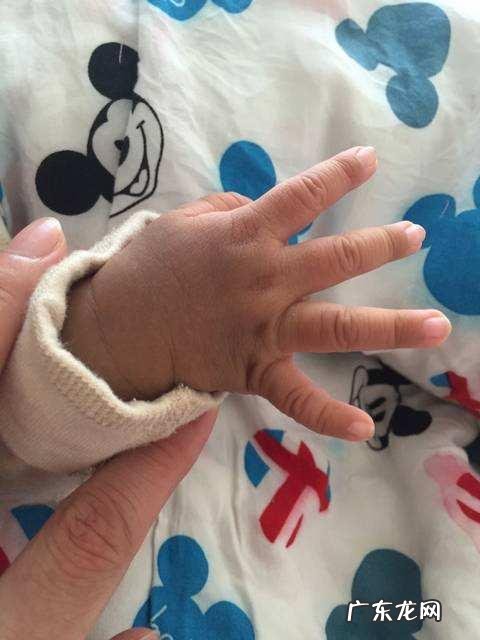 新生儿常见问题轻松应对