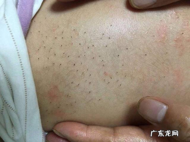 新生儿常见问题轻松应对