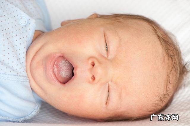 新生儿的几种特殊生理现象