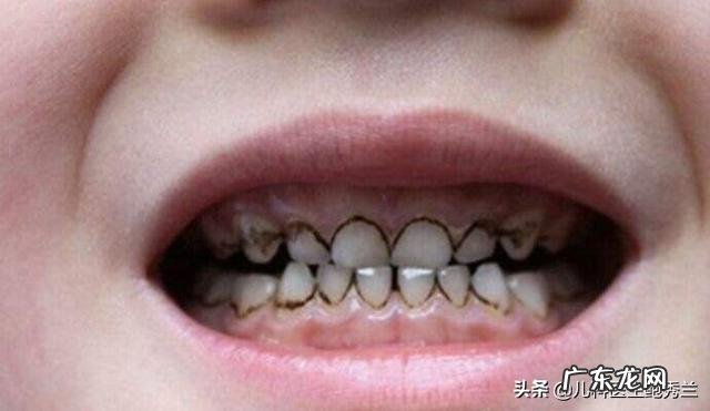 宝宝几个月才长牙,为什么?要注意什么?