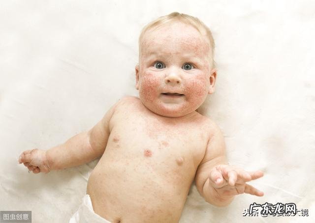 新生儿检查内容 新生儿应重点监测的内容