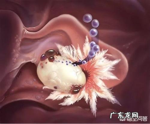 做彩超发现多囊,影响怀孕吗?