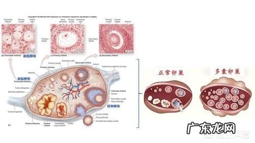 做彩超发现多囊,影响怀孕吗?