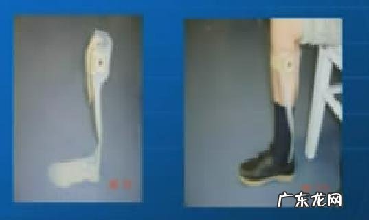 孕妇分娩为什么要做侧切呢？